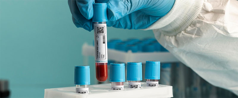 Label on blood sample